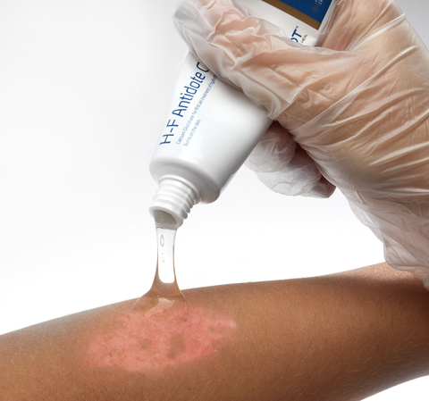 Hand applying a white cream to a person's arm with a visible red mark, against a white background.